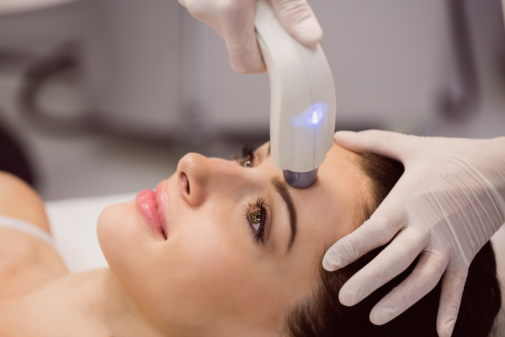 Profissional aplicando Laser Lavitan no rosto de uma mulher com manchas na pele